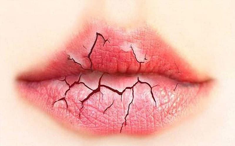 dùng thuốc kháng histamin kéo dài