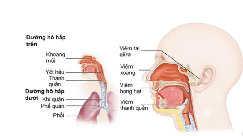 Viêm đường hô hấp trên gồm những bệnh gì?