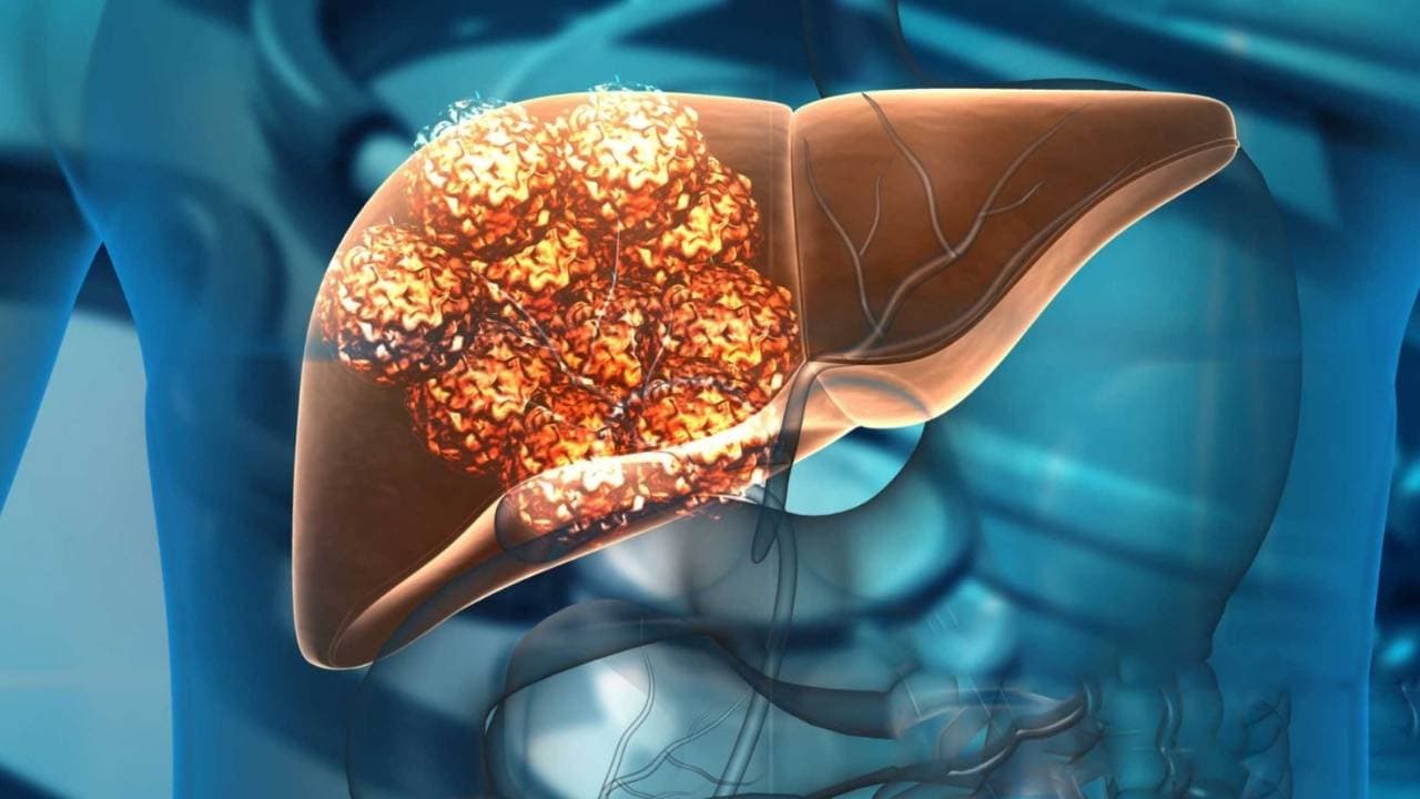 viêm gan c bao gồm mấy type