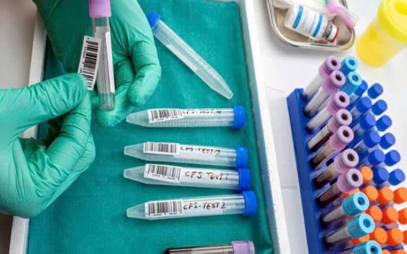 viêm màng não có tái phát không