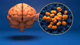 Bệnh viêm màng não có khỏi hẳn không?