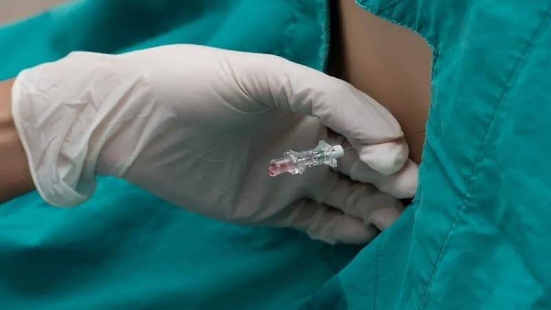 enterovirus gây viêm màng não