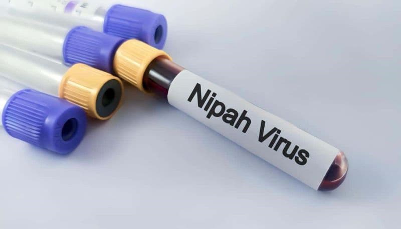 Nguồn gốc virus Nipah Ấn Độ, lây qua đường nào?