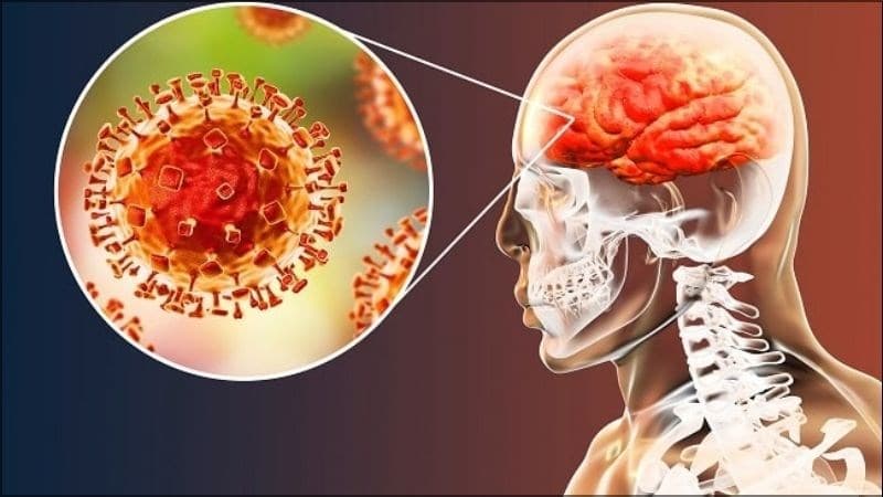 Nguồn gốc virus Nipah Ấn Độ, lây qua đường nào?