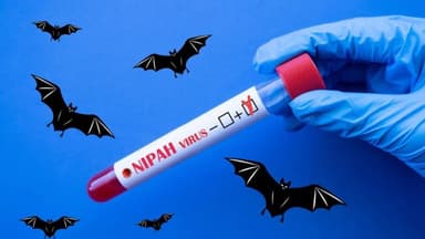Đặc tính virus Nipah, độc lực cao thế nào?