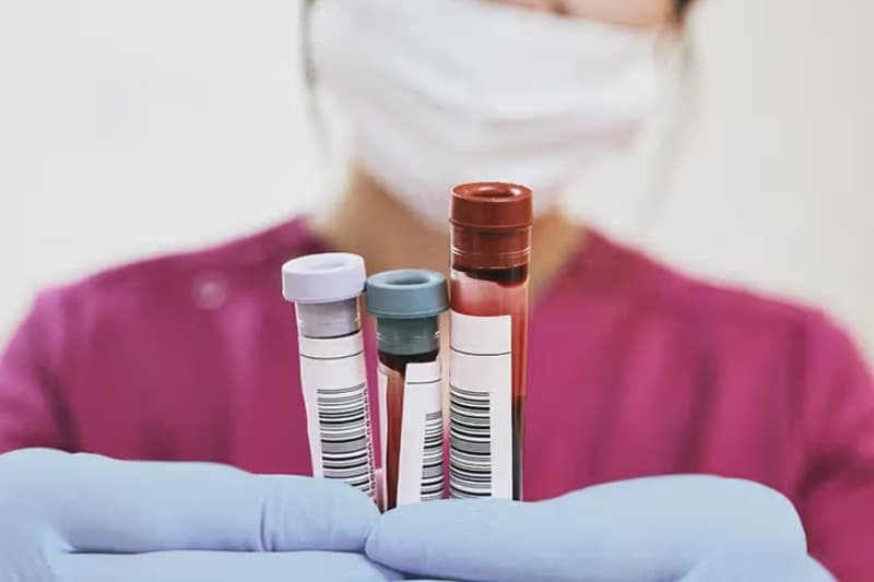 xét nghiệm axit uric có phải nhịn ăn không