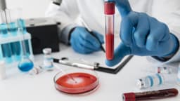 Xét nghiệm đột biến gen EGFR ung thư phổi