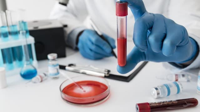 Xét nghiệm đột biến gen EGFR ung thư phổi