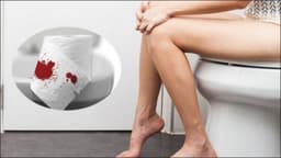 Xuất huyết hậu môn là bệnh gì?