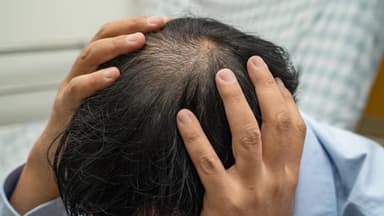 Cắt u da đầu đường kính dưới 5cm: Khi nào cần và quy trình thực hiện