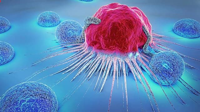 Chỉ định phẫu thuật u da lành tính