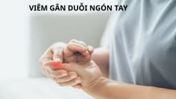 Viêm gân duỗi ngón tay: Nguyên nhân, dấu hiệu và cách điều trị hiệu quả