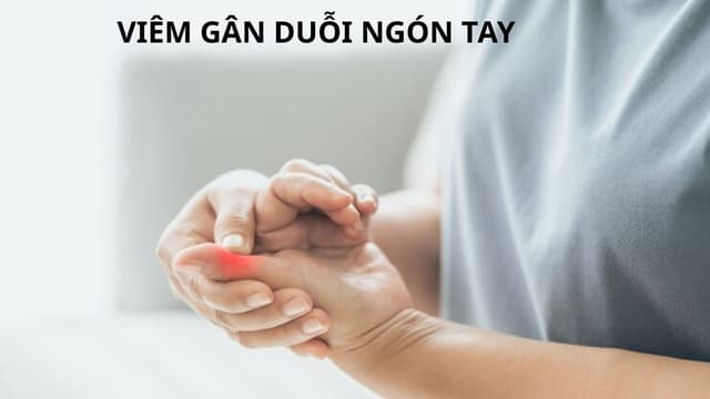 Viêm gân duỗi ngón tay: Nguyên nhân, dấu hiệu và cách điều trị hiệu quả