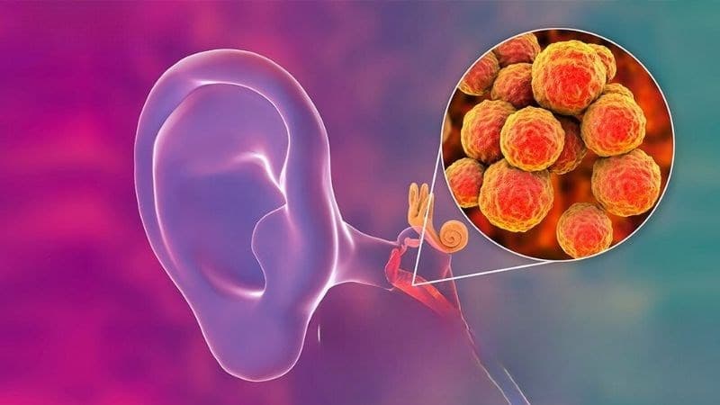 di chứng của bệnh áp xe não