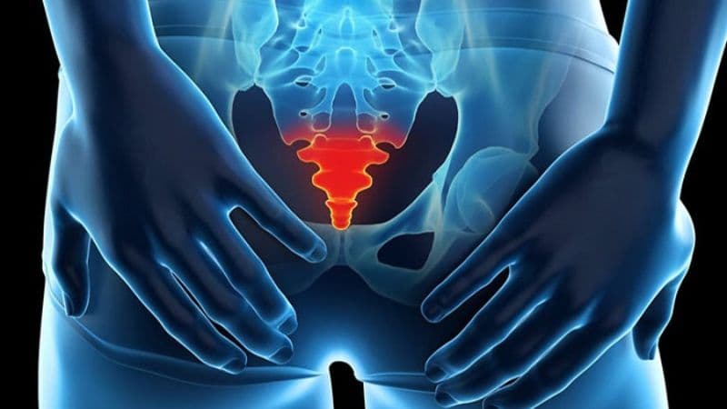 viêm rò xoang lông vùng cùng cụt