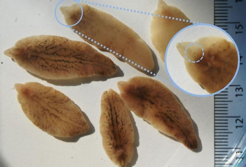 sán lá gan lớn có chữa khỏi không