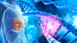 Đặc điểm bệnh ung thư vú do đột biến gen