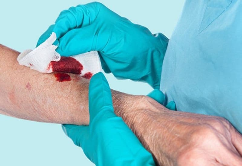 bị rách da nên làm gì