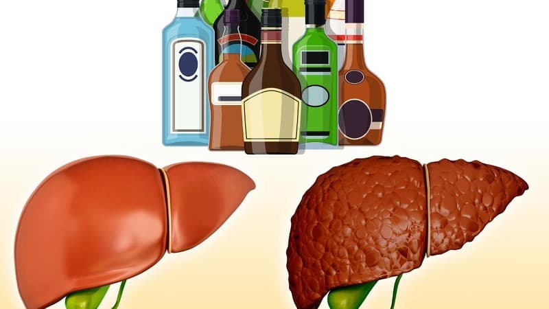 uống nhiều rượu bia gây ung thư gì