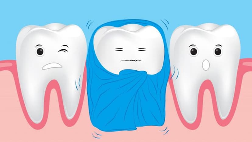 Các cách hết ê răng hiệu quả nhất