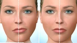 Cách khắc phục mặt lệch do mất răng