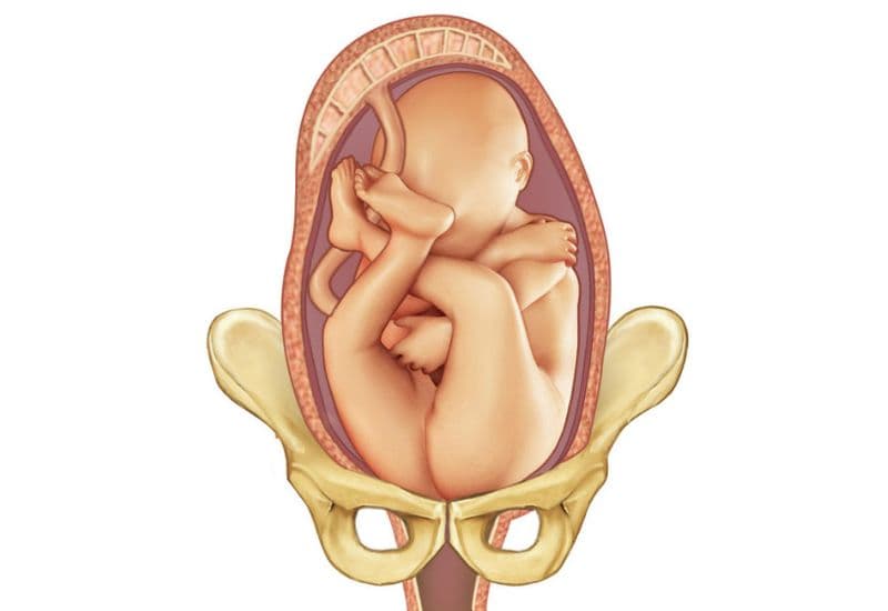 cách xoay ngôi thai ngược