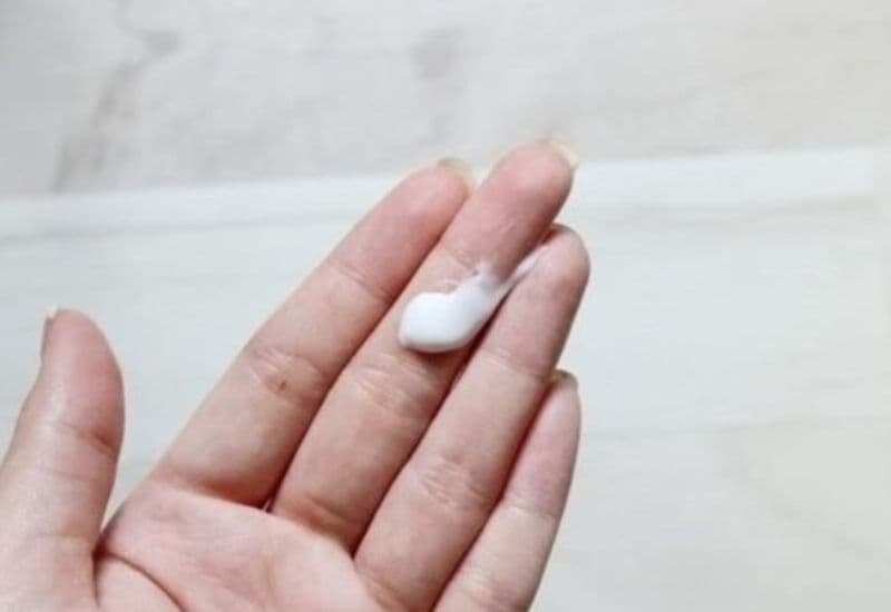 cắt da thừa hậu môn bao lâu thì lành