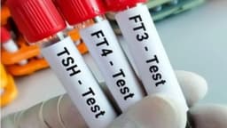 Các chỉ số chẩn đoán cường giáp thai kỳ