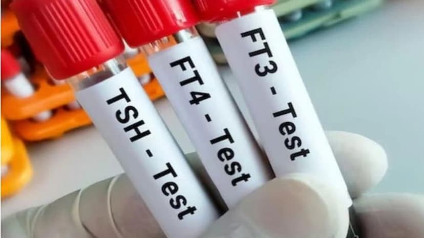 Các chỉ số chẩn đoán cường giáp thai kỳ