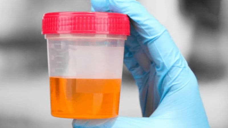 trong nước tiểu có chất gì