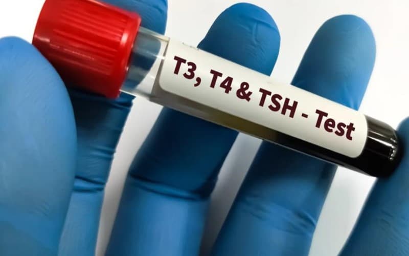 chẩn đoán cường giáp thai kỳ