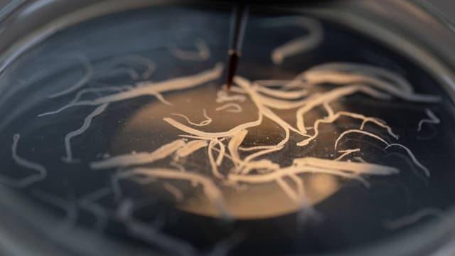 Các chỉ số xét nghiệm sán lá gan lớn