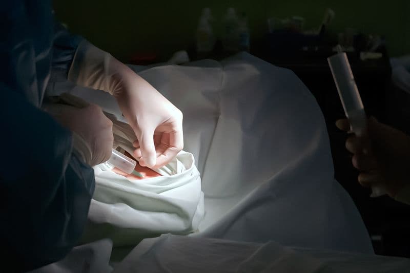 áp xe lòng bàn tay