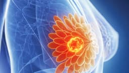 Chỉ định chụp x quang tuyến vú?