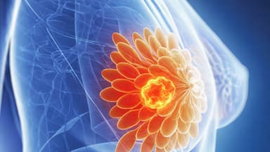 Chỉ định chụp x quang tuyến vú?