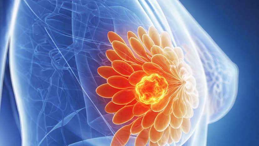 Chỉ định chụp x quang tuyến vú?