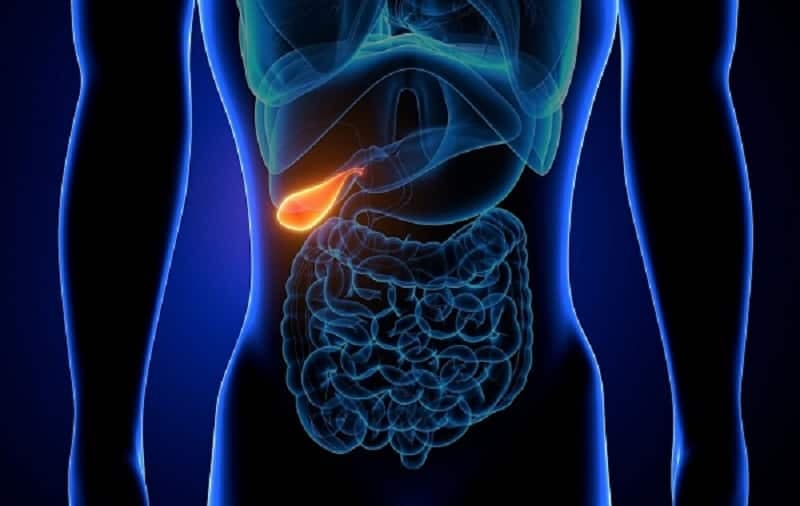 đa polyp túi mật