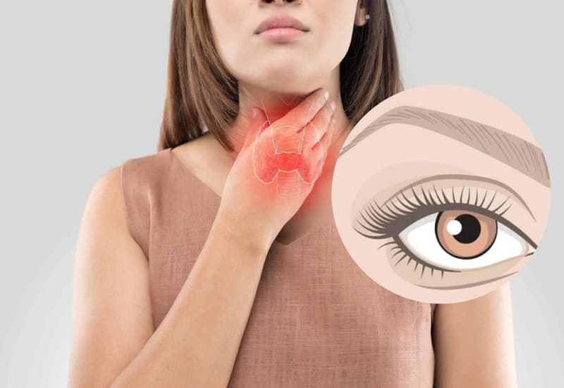 biểu hiện cường giáp khi mang thai