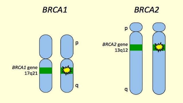 Đột biến gen BRCA1 và BRCA2 trong các loại ung thư nào?