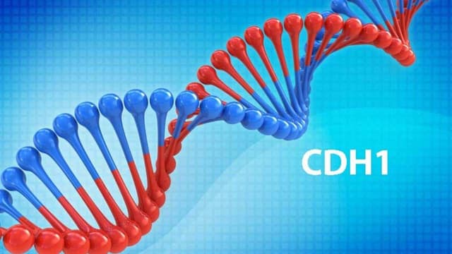 Nguy cơ ung thư ở người mang đột biến gen CDH1