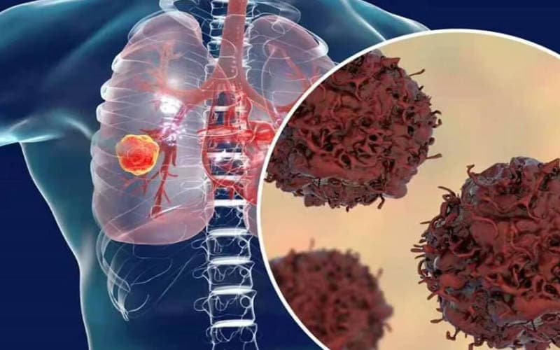 đột biến gen tp53