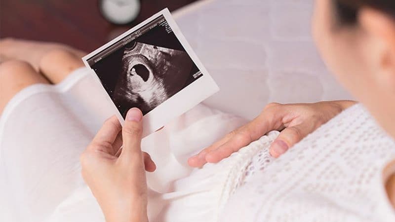 hiện tượng thai máy 3 tháng đầu