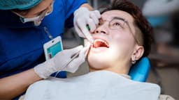 Niềng răng: Kéo cụm 4 răng cửa mất bao lâu?