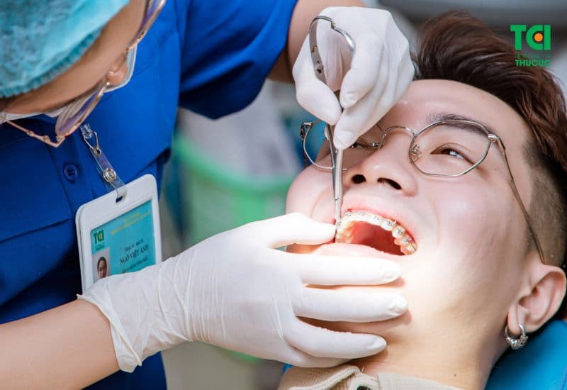 kéo răng 3 vào răng 5 mất bao lâu