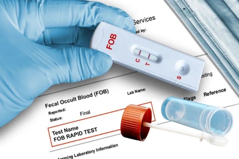 các xét nghiệm ung thư đại trực tràng