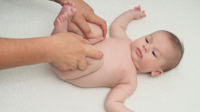 Không có hậu môn bẩm sinh: Điều trị thế nào?