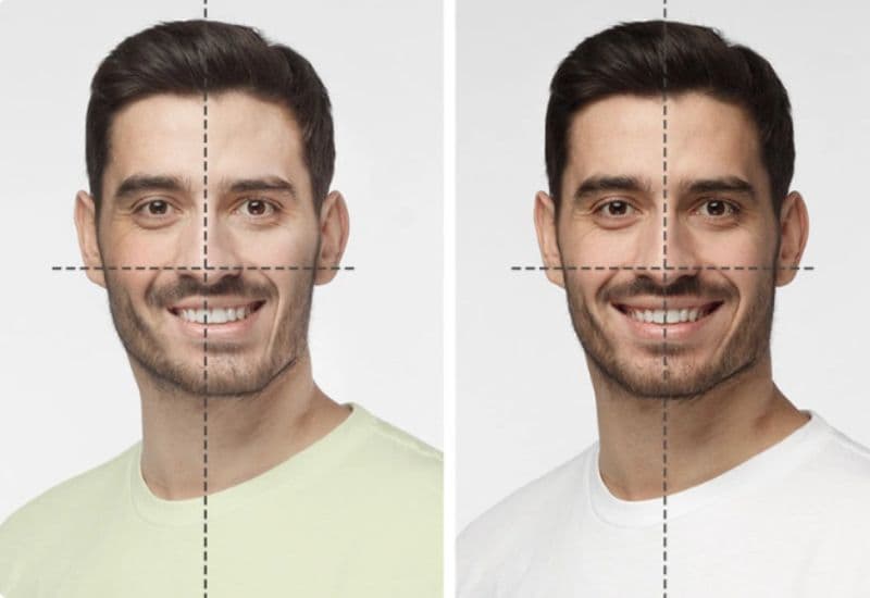 mất răng hàm có bị lệch mặt không