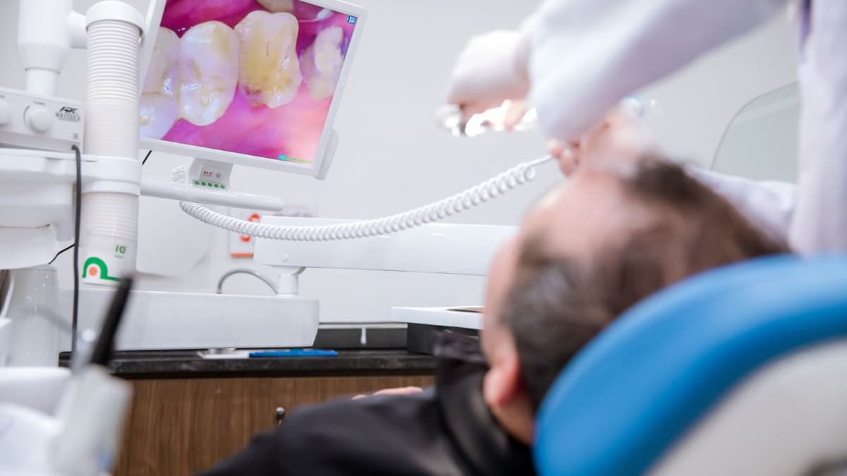 Mất răng số 7 có sao không? Có gây hóp má, lệch mặt?