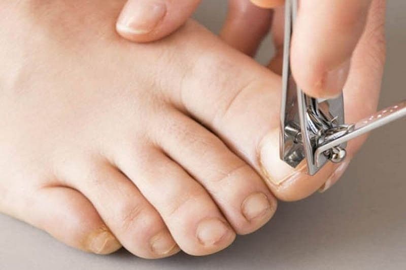 cách chữa móng chọc thịt tại nhà