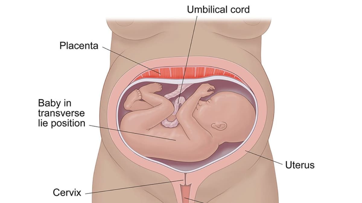 Ngôi thai chưa cố định là gì và những điều cần lưu ý